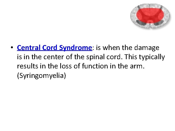  • Central Cord Syndrome: is when the damage is in the center of