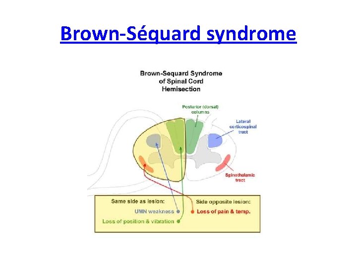 Brown-Séquard syndrome 