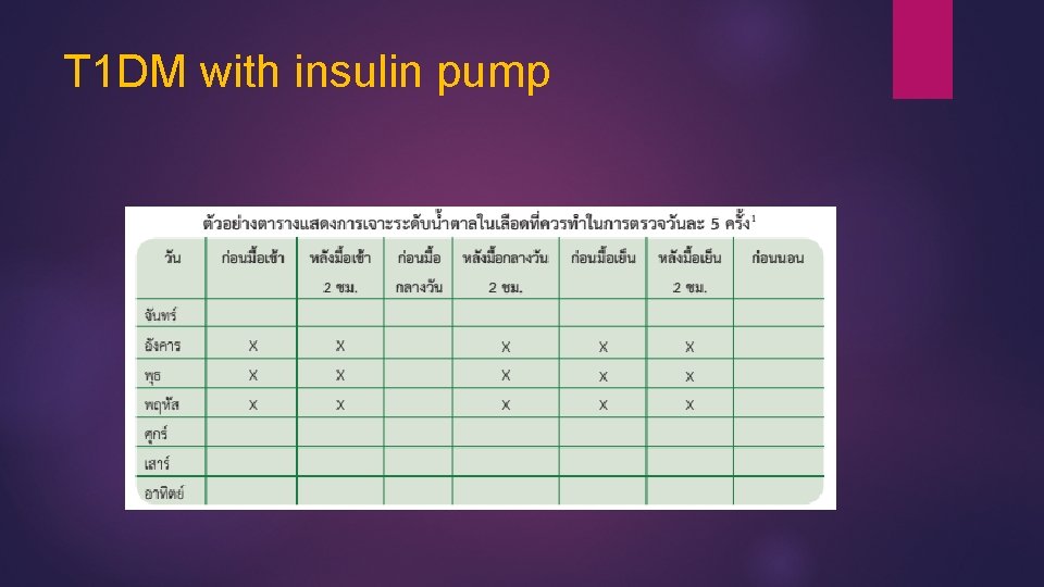 T 1 DM with insulin pump 