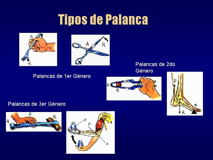 Tipos de Palancas de 1 er Género Palancas de 3 er Género Palancas de