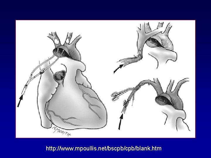 http: //www. mpoullis. net/bscpb/blank. htm 