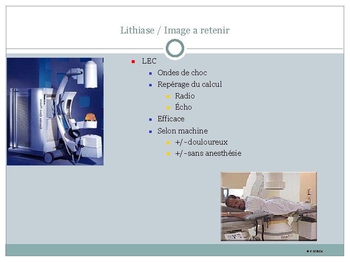 Lithiase / Image a retenir LEC Ondes de choc Repérage du calcul Radio Écho