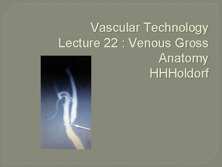 Vascular Technology Lecture 22 : Venous Gross Anatomy HHHoldorf 