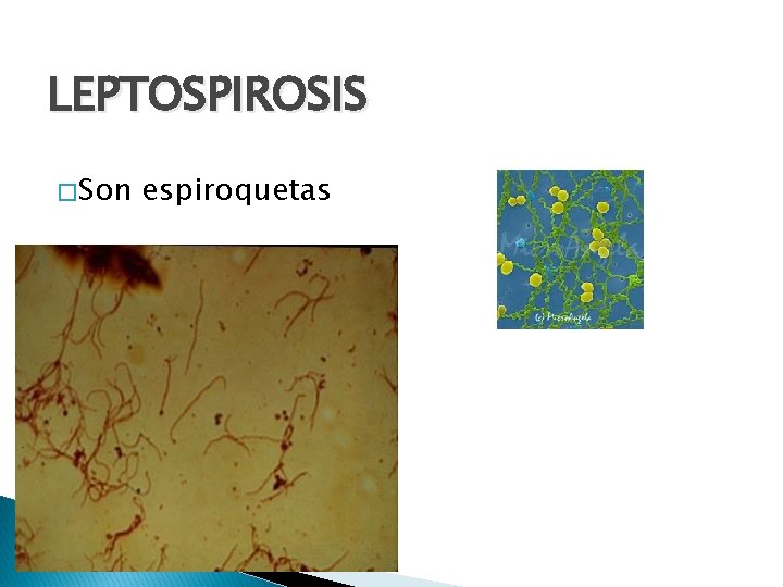 LEPTOSPIROSIS � Son espiroquetas 