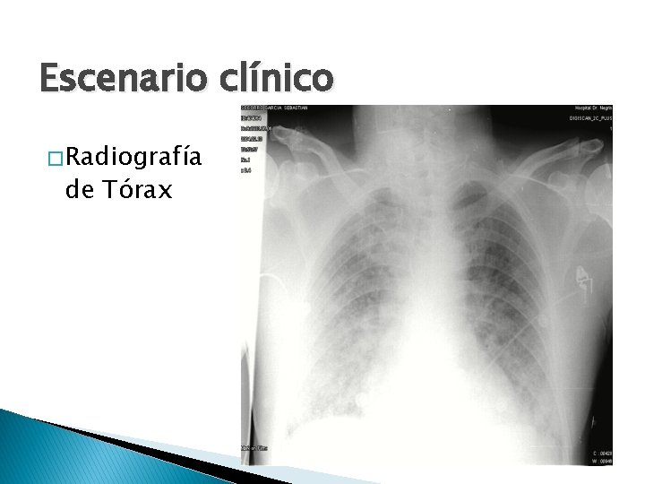 Escenario clínico � Radiografía de Tórax 