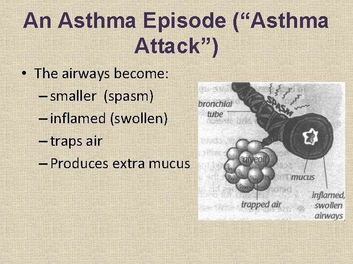 An Asthma Episode (“Asthma Attack”) • The airways become: – smaller (spasm) – inflamed