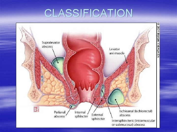 CLASSIFICATION 