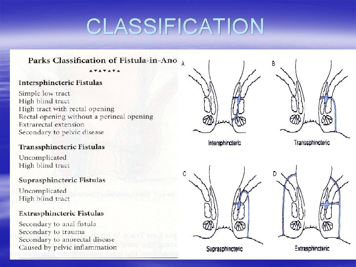 CLASSIFICATION 
