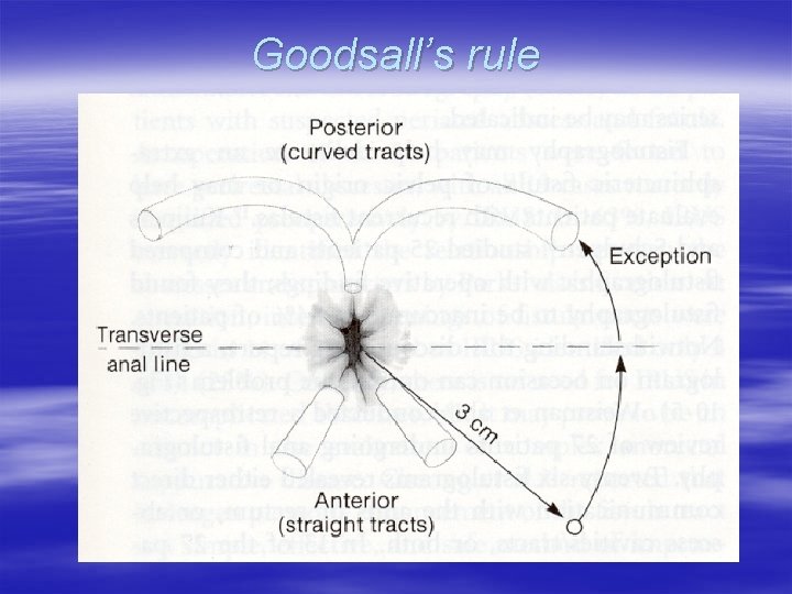 Goodsall’s rule 
