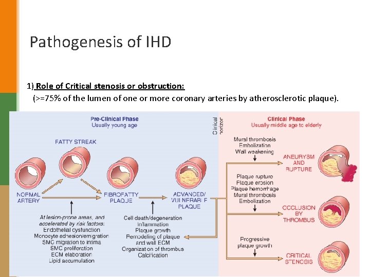 Pathogenesis of IHD 1) Role of Critical stenosis or obstruction: (>=75% of the lumen