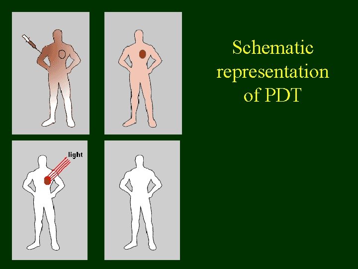 Schematic representation of PDT 