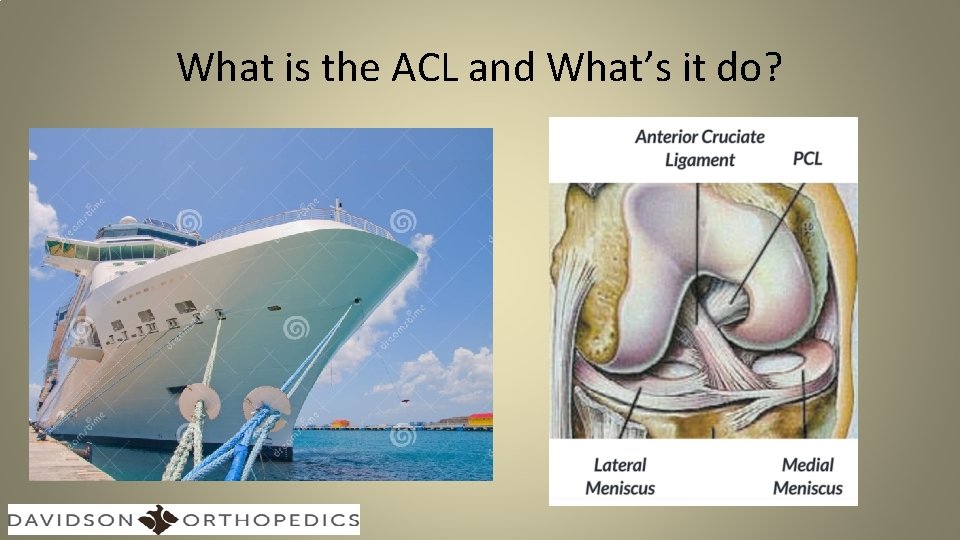 What is the ACL and What’s it do? 