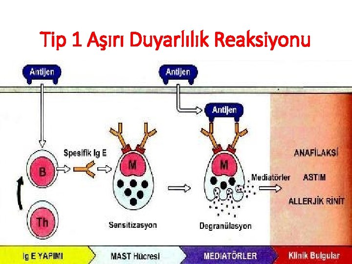 Tip 1 Aşırı Duyarlılık Reaksiyonu 