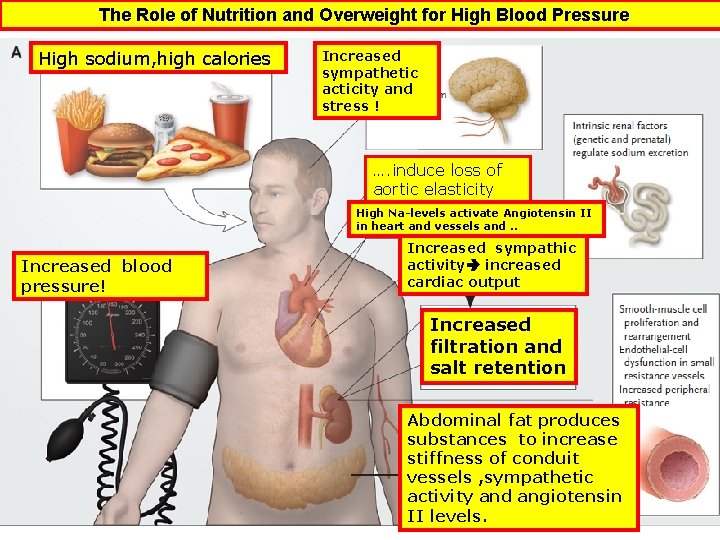 The Role of Nutrition and Overweight for High Blood Pressure High sodium, high calories