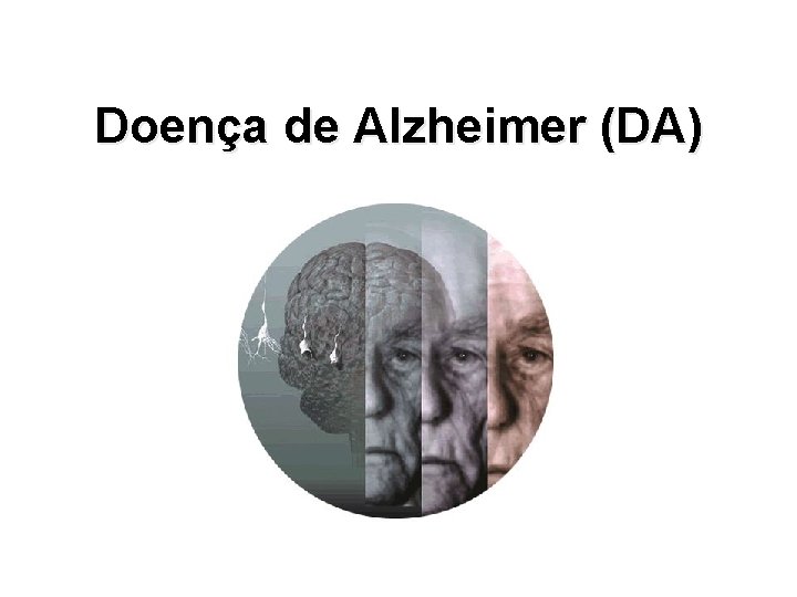 Doença de Alzheimer (DA) 