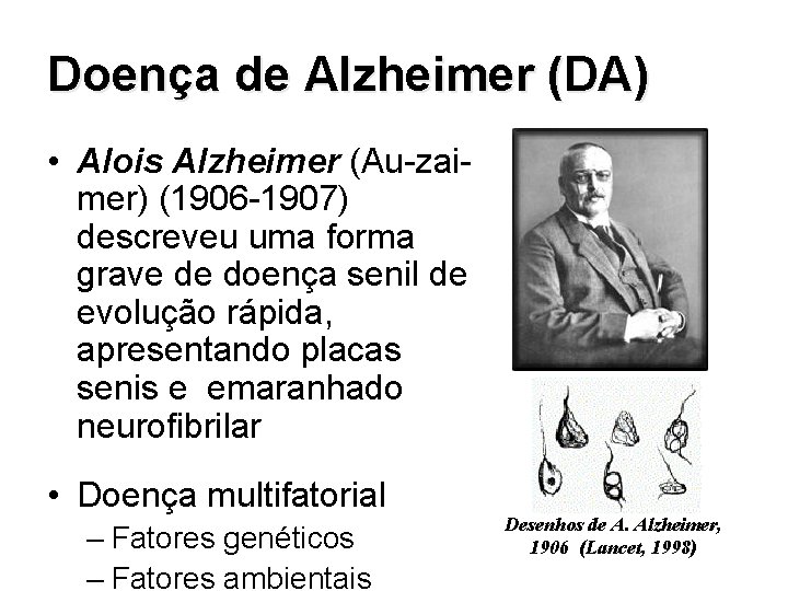 Doença de Alzheimer (DA) • Alois Alzheimer (Au-zaimer) (1906 -1907) descreveu uma forma grave
