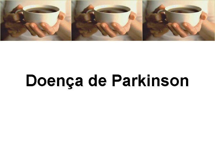 Doença de Parkinson 