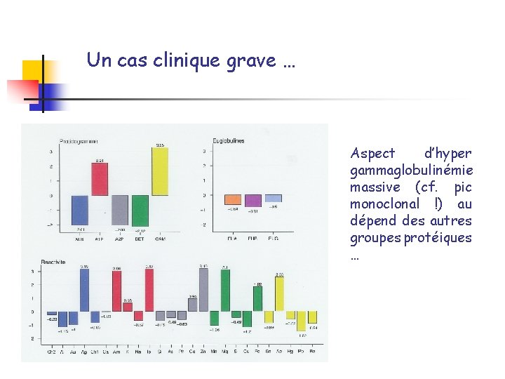 Un cas clinique grave … Aspect d’hyper gammaglobulinémie massive (cf. pic monoclonal !) au