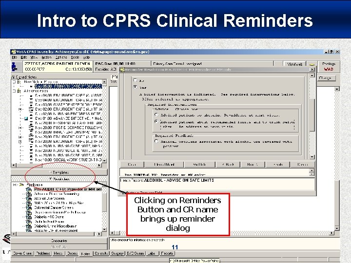 Intro to CPRS Clinical Reminders Clicking on Reminders Button and CR name brings up Intro to CPRS Clinical Reminders Clicking on Reminders Button and CR name brings up
