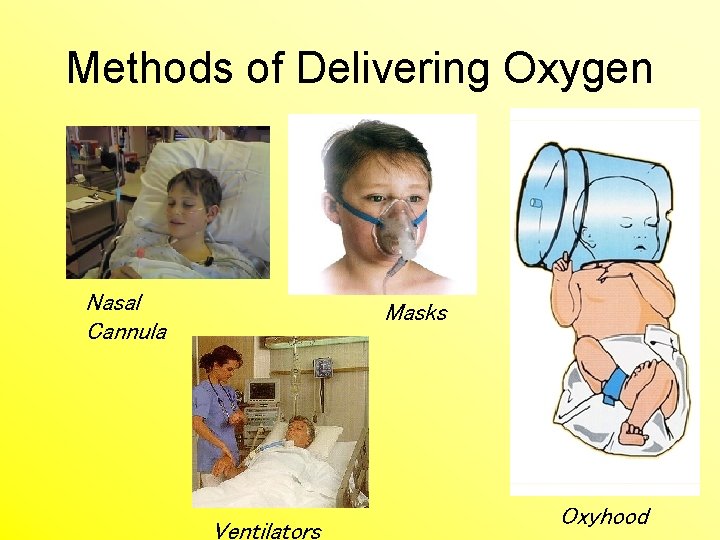 Methods of Delivering Oxygen Nasal Cannula Masks Ventilators Oxyhood 