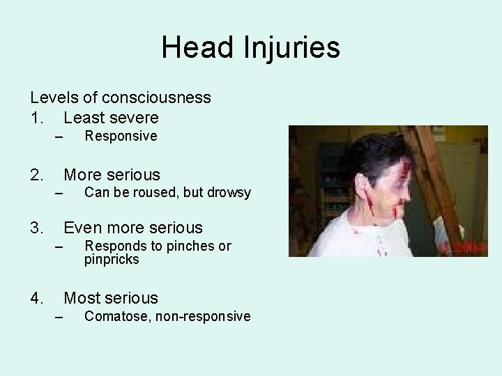 Head Injuries Levels of consciousness 1. Least severe – 2. Responsive More serious –