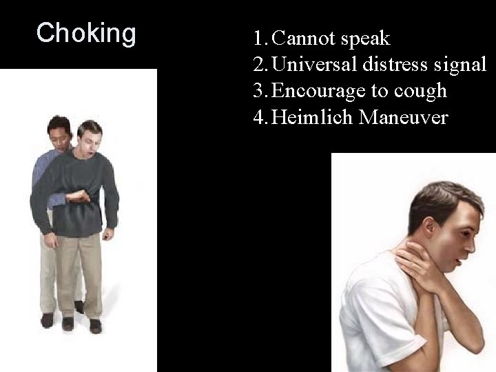 Choking 1. Cannot speak 2. Universal distress signal 3. Encourage to cough 4. Heimlich