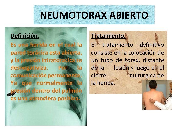 NEUMOTORAX ABIERTO Definición. Es una herida en el cual la pared torácica esta abierta,