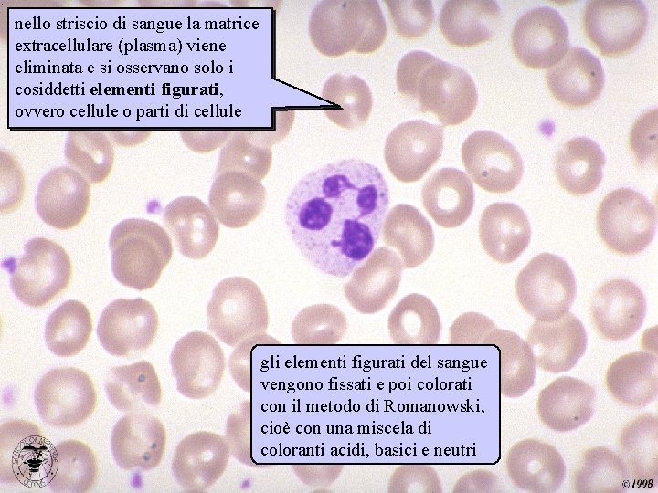 nello striscio di sangue la matrice extracellulare (plasma) viene eliminata e si osservano solo
