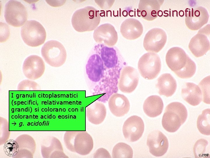 granulocito eosinofilo I granuli citoplasmatici (specifici, relativamente grandi) si colorano con il colorante acido
