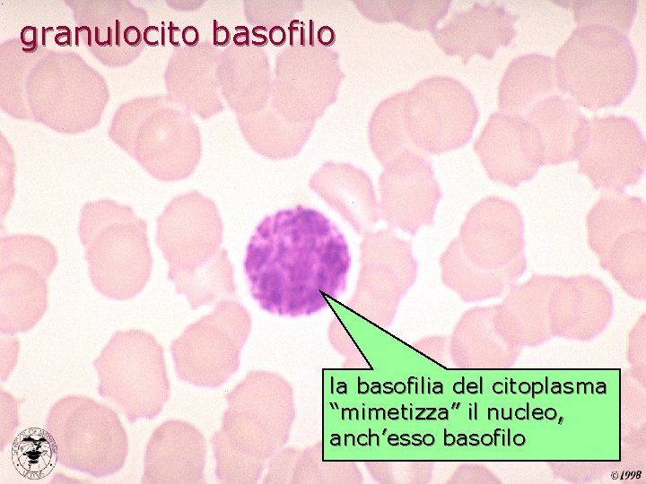 granulocito basofilo la basofilia del citoplasma “mimetizza” il nucleo, anch’esso basofilo 