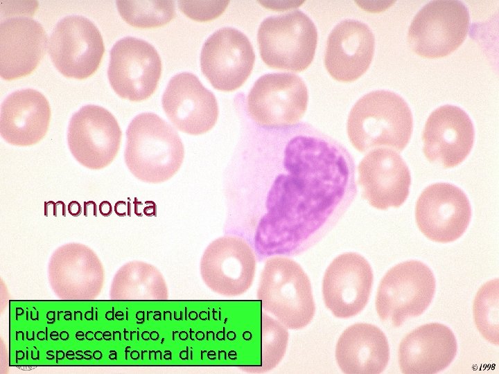 monocita Più grandi dei granulociti, nucleo eccentrico, rotondo o più spesso a forma di