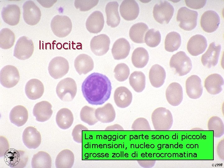 linfocita La maggior parte sono di piccole dimensioni, nucleo grande con grosse zolle di