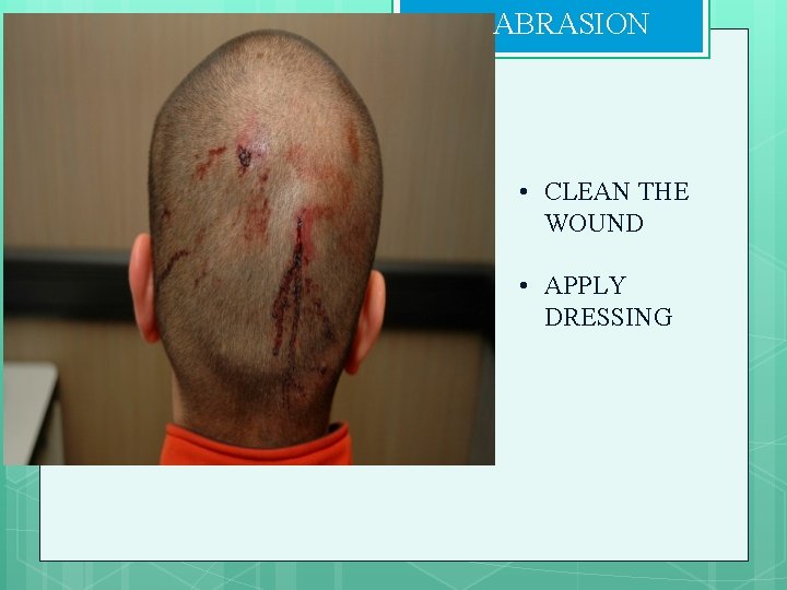 ABRASION • CLEAN THE WOUND • APPLY DRESSING 