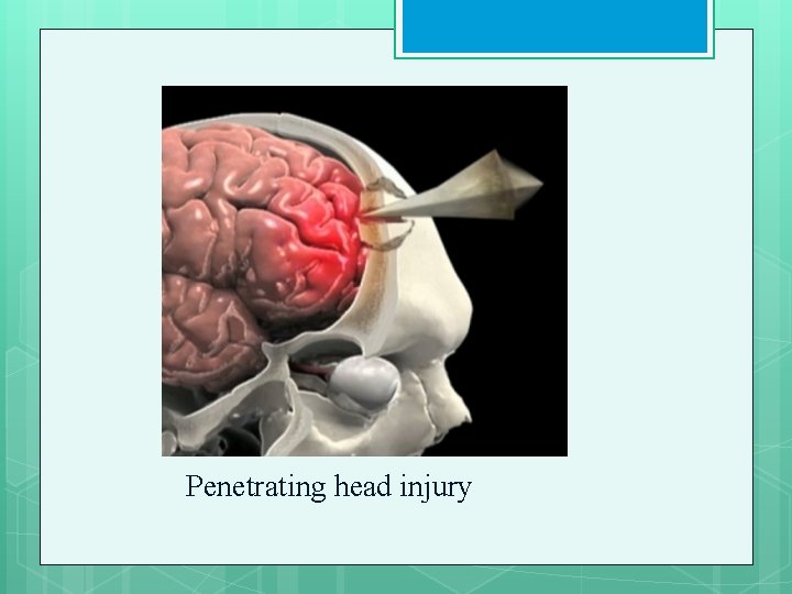 Penetrating head injury 