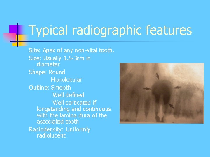 Typical radiographic features Site: Apex of any non-vital tooth. Size: Usually 1. 5 -3 Typical radiographic features Site: Apex of any non-vital tooth. Size: Usually 1. 5 -3
