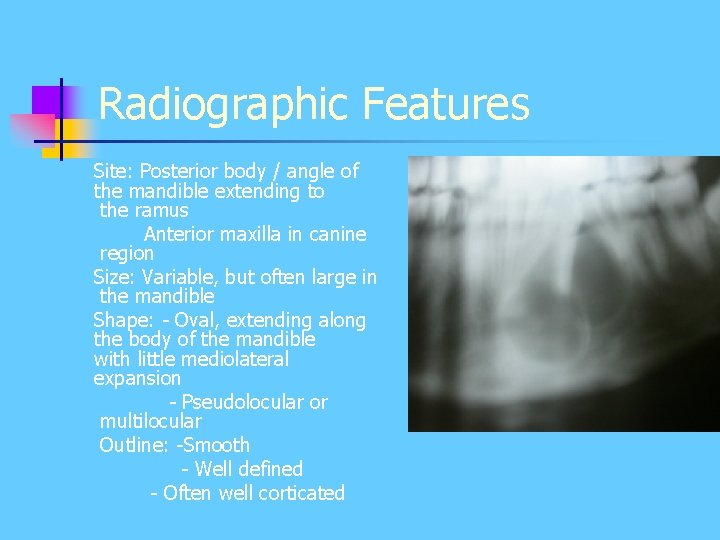 Radiographic Features Site: Posterior body / angle of the mandible extending to the ramus Radiographic Features Site: Posterior body / angle of the mandible extending to the ramus