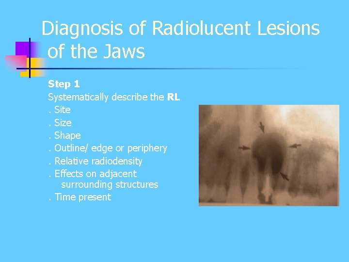 Diagnosis of Radiolucent Lesions of the Jaws Step 1 Systematically describe the RL. Site. Diagnosis of Radiolucent Lesions of the Jaws Step 1 Systematically describe the RL. Site.
