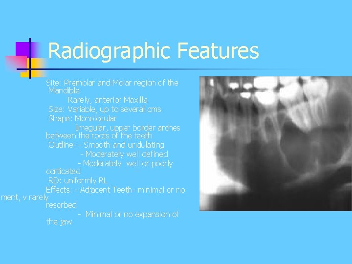 Radiographic Features Site: Premolar and Molar region of the Mandible Rarely, anterior Maxilla Size: Radiographic Features Site: Premolar and Molar region of the Mandible Rarely, anterior Maxilla Size: