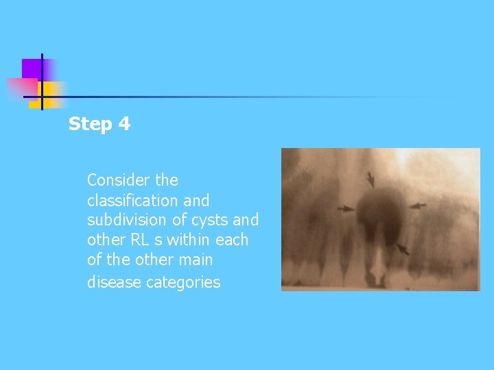 Step 4 Consider the classification and subdivision of cysts and other RL s within Step 4 Consider the classification and subdivision of cysts and other RL s within