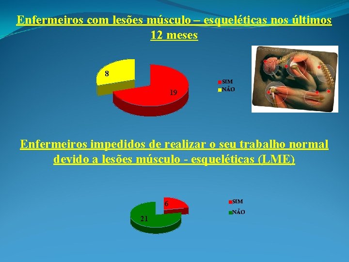 Enfermeiros com lesões músculo – esqueléticas nos últimos 12 meses 8 19 SIM NÃO