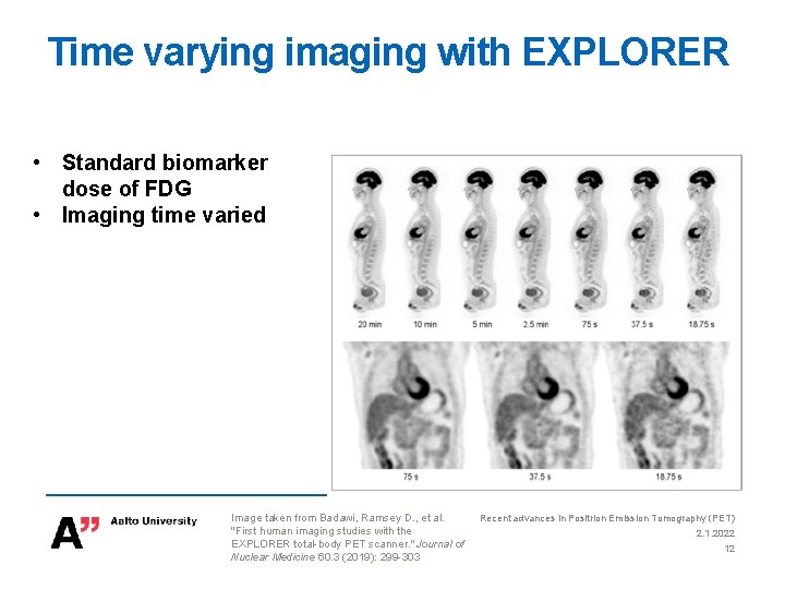 Time varying imaging with EXPLORER • Standard biomarker dose of FDG • Imaging time