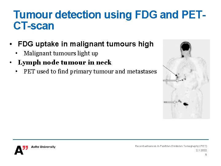 Tumour detection using FDG and PETCT-scan • FDG uptake in malignant tumours high •