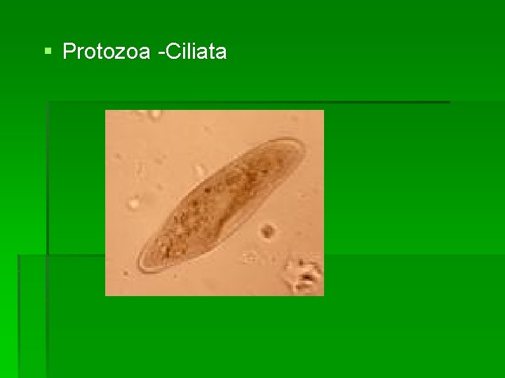 § Protozoa -Ciliata 