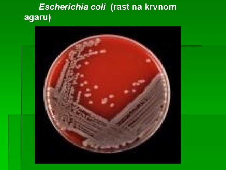 Escherichia coli (rast na krvnom agaru) 