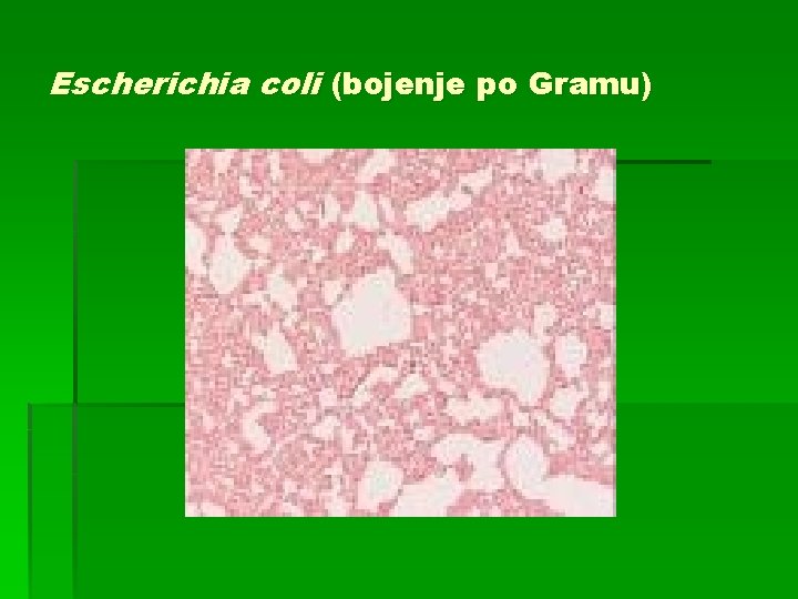 Escherichia coli (bojenje po Gramu) 