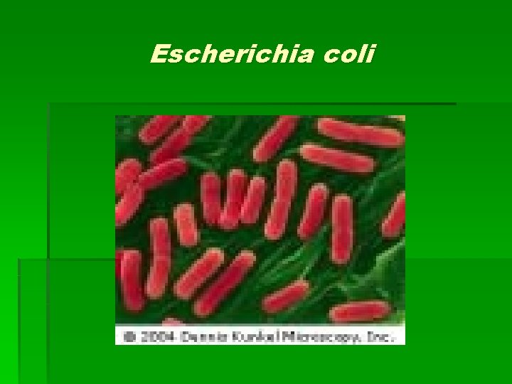 Escherichia coli 