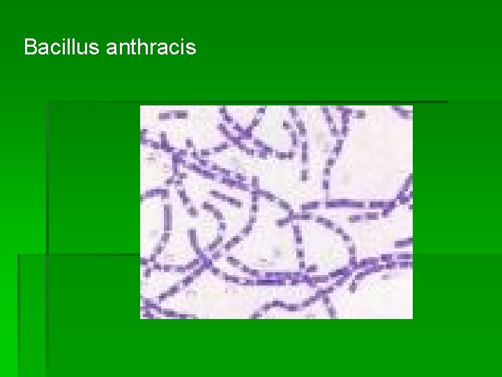 Bacillus anthracis 