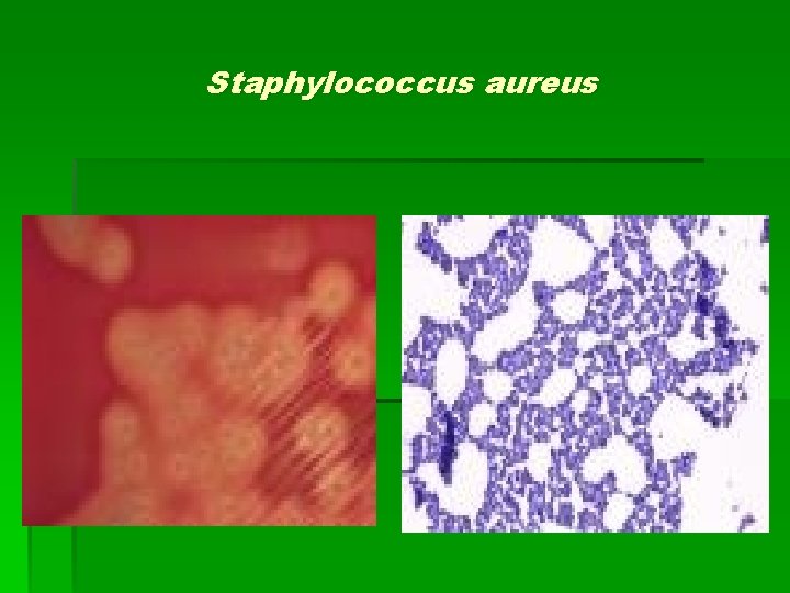 Staphylococcus aureus 