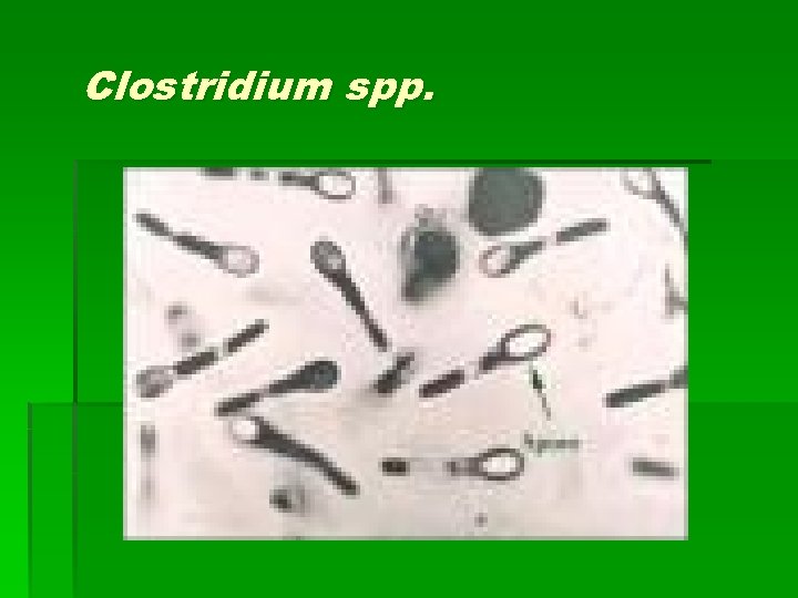 Clostridium spp. 
