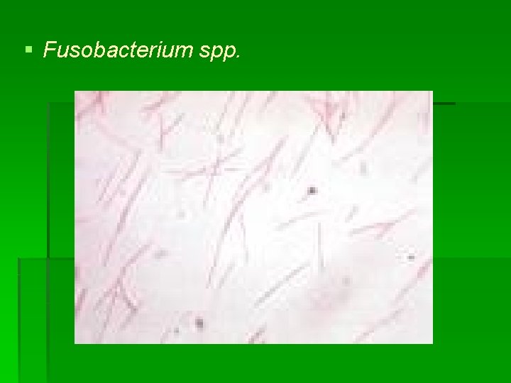 § Fusobacterium spp. 